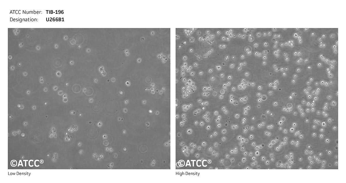 Cell Micrograph of ATCC TIB-196, U266B1