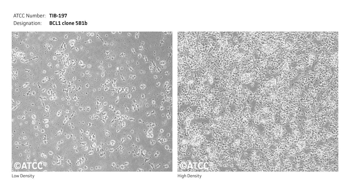 BCL1 clone 5B1b, mouse B lymphocyte, ATCC TIB-197 Cell Micrograph