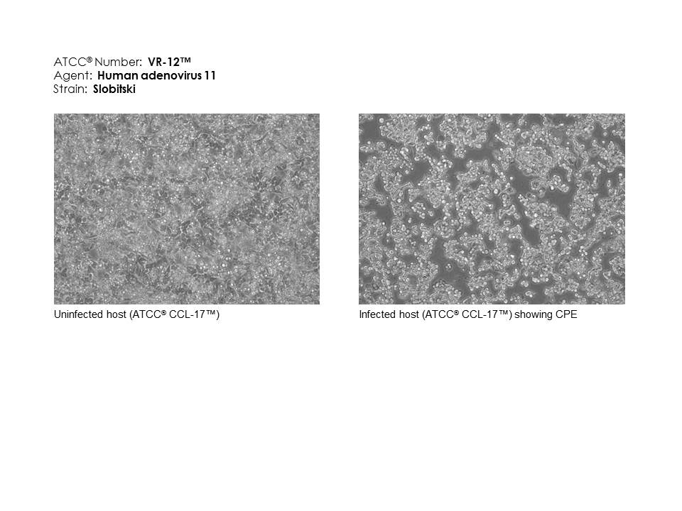 ATCC VR-12 micrograph of host effects