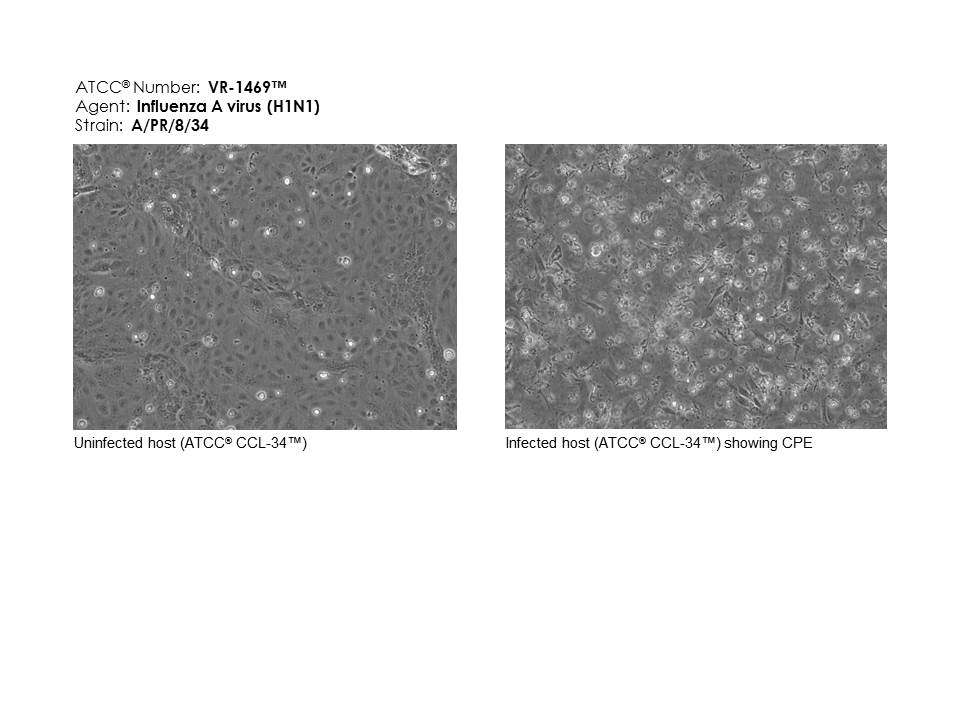 ATCC VR-1469 micrograph images