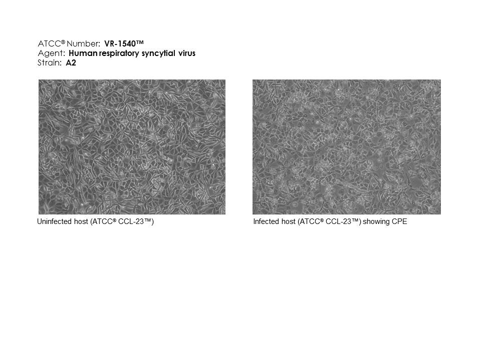 Human respiratory syncytial virus ATCC VR-1540 images