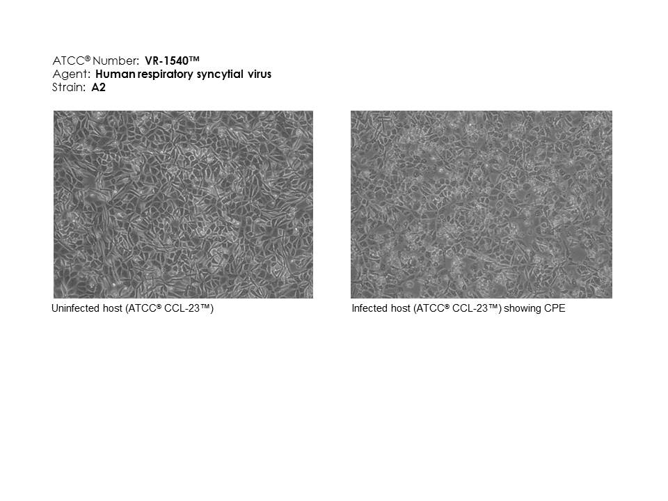 Human respiratory syncytial virus ATCC VR-1540 images