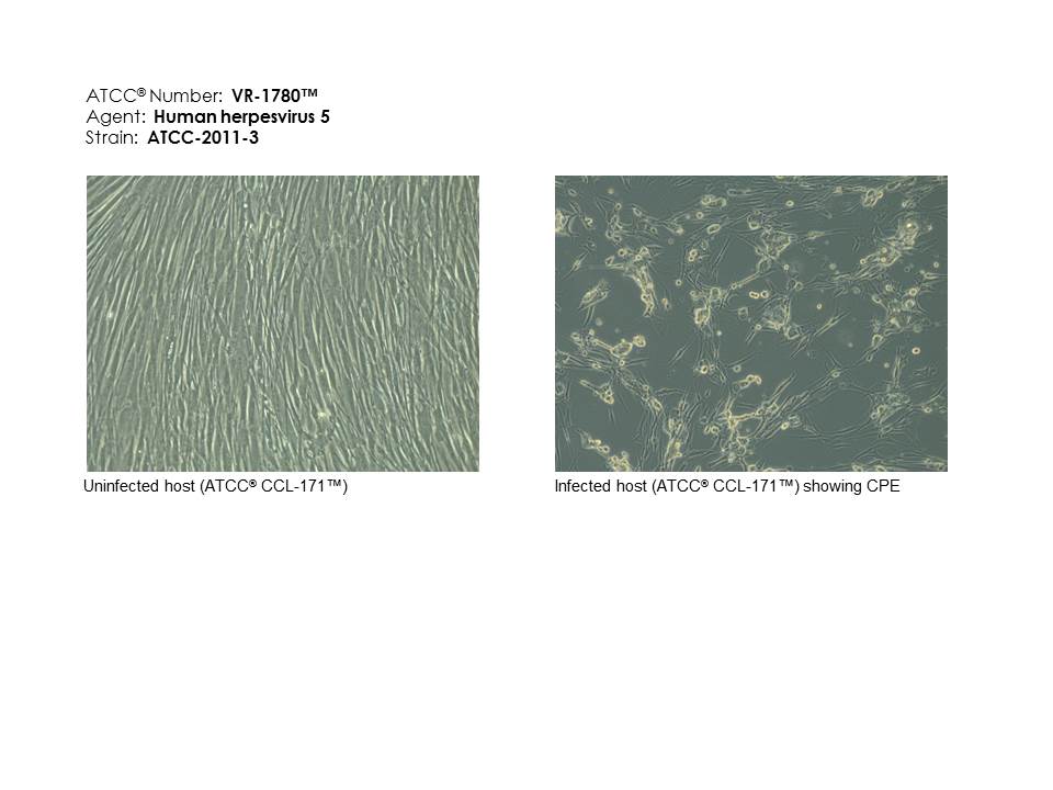 ATCC VR-1780 Micrograph