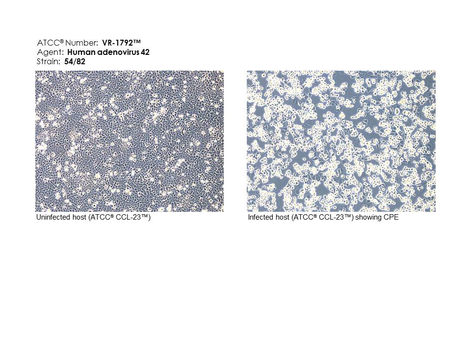 VR-1792 Photomicrograph