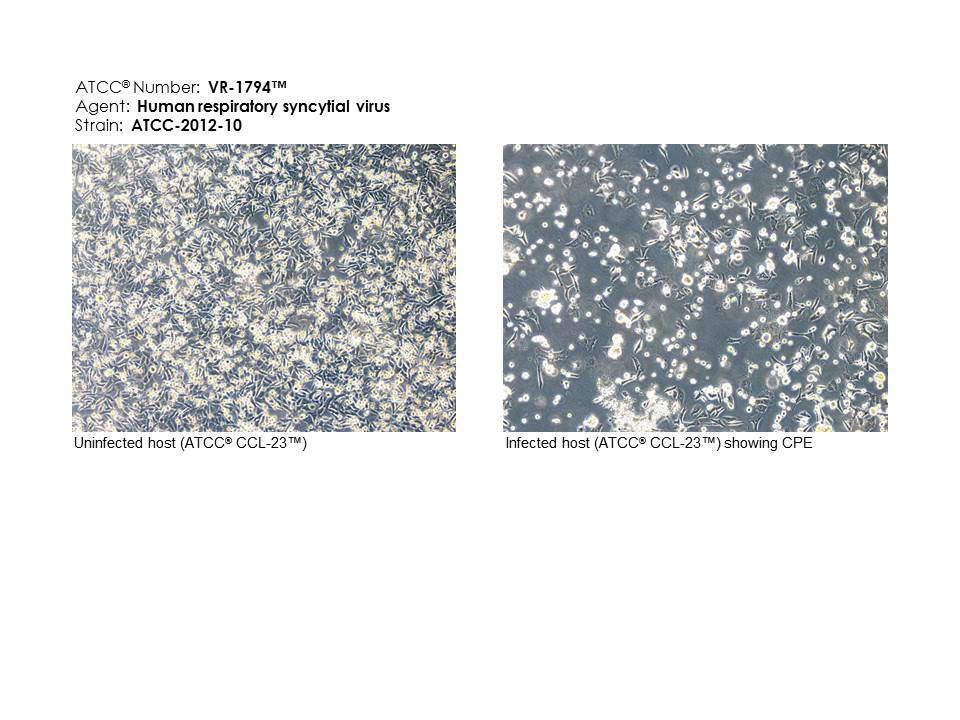 VR-1794 Photomicrograph