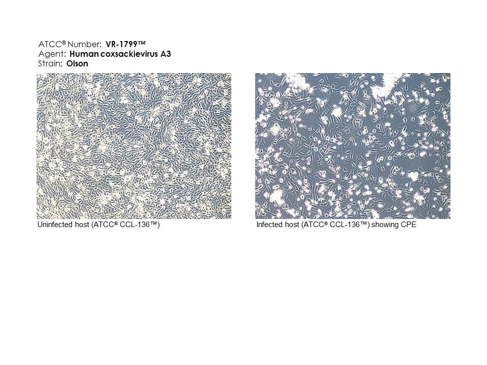 ATCC VR-1799 Photomicrographs