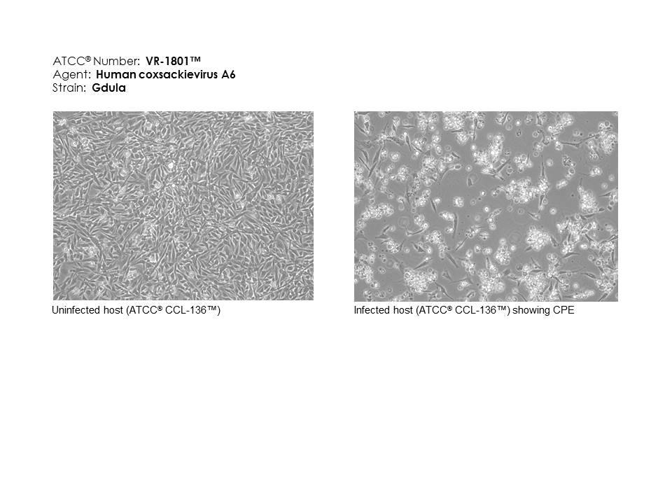 ATCC VR-1801 Photomicrographs