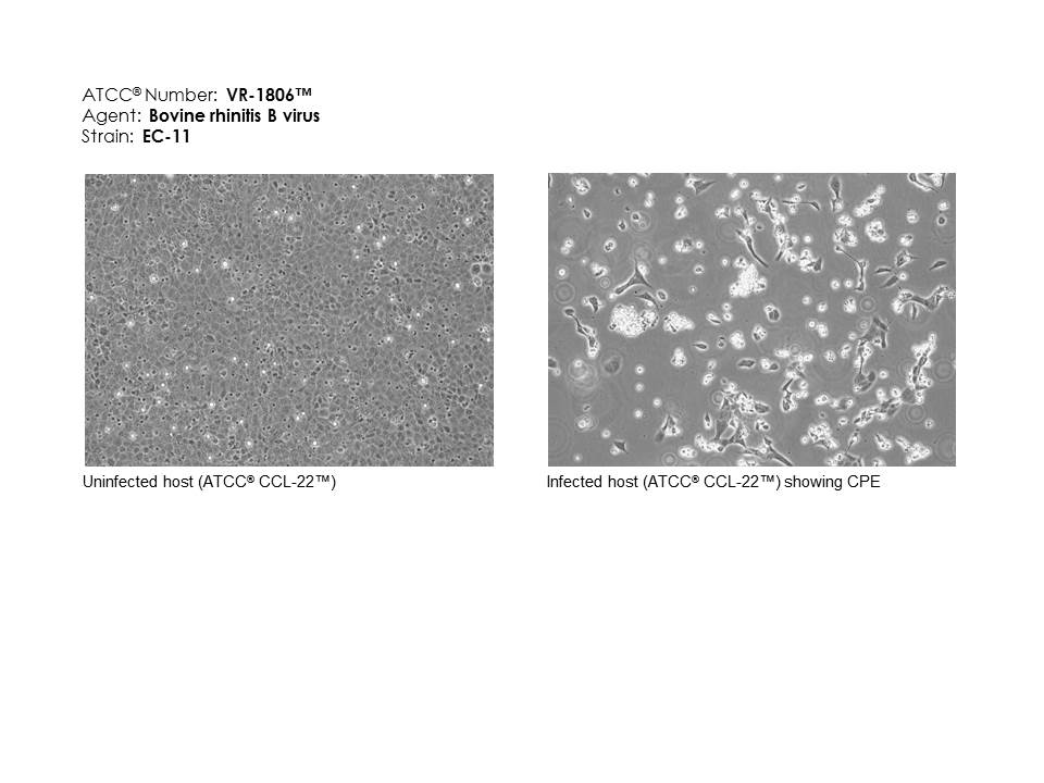 ATCC VR-1806 Cell Micrograph