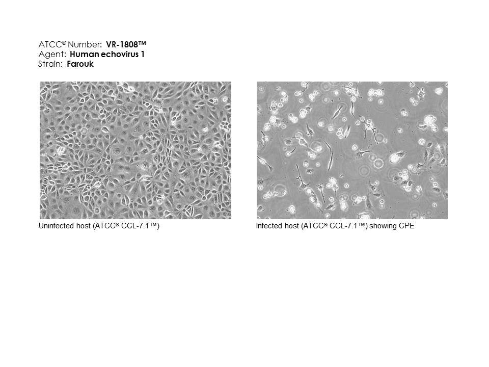 ATCCC VR-1808 Micrograph