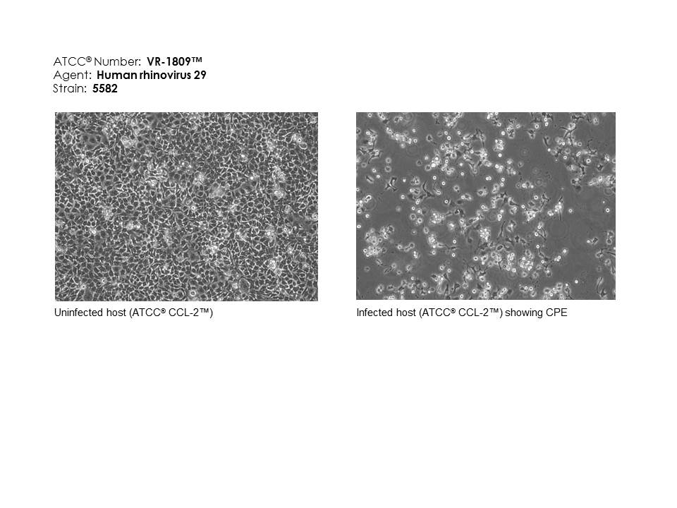 ATCC VR-1809 Cell Micrograph