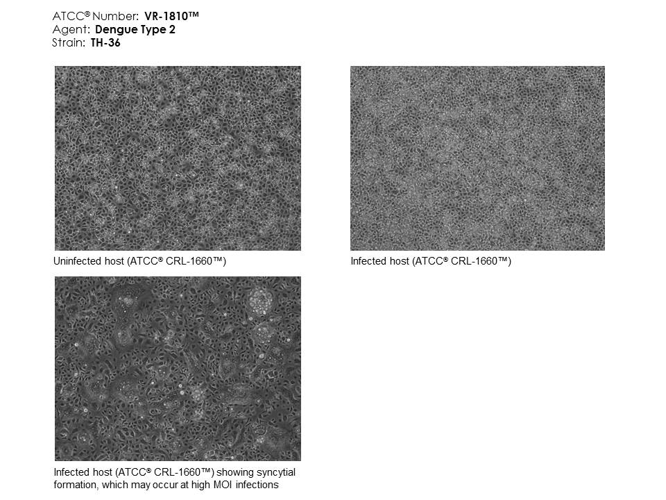 ATCC VR-1810 micrograph of host effects