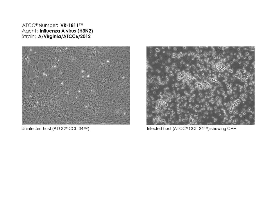 ATCC VR-1811 images