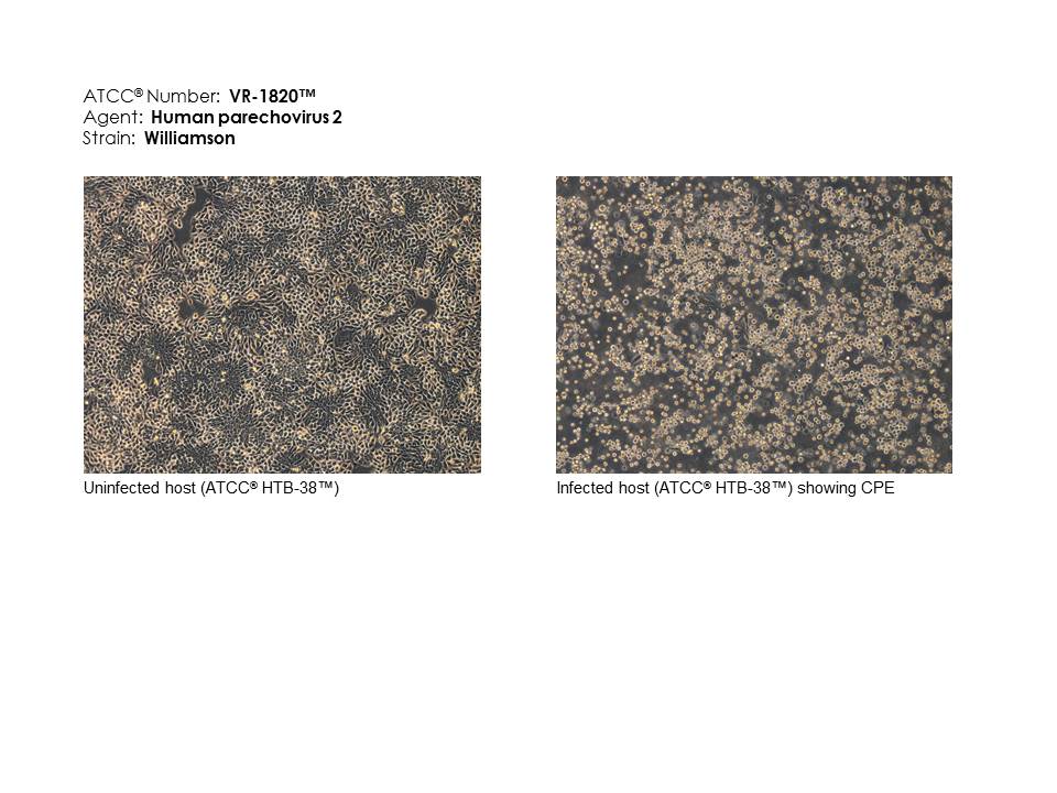 ATCC VR-1820 Photomicrograph