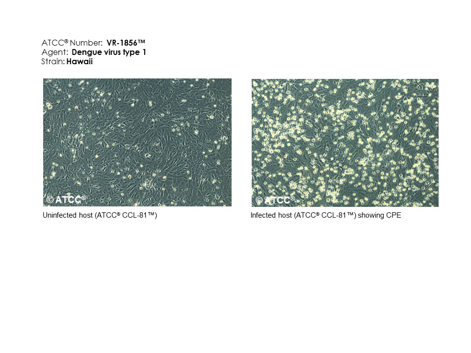 Dengue virus type 1 - VR-1856 | ATCC