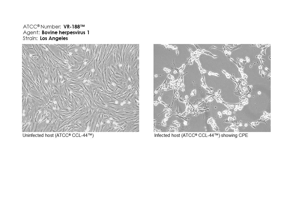 ATCC VR-188 uninfected and infected images