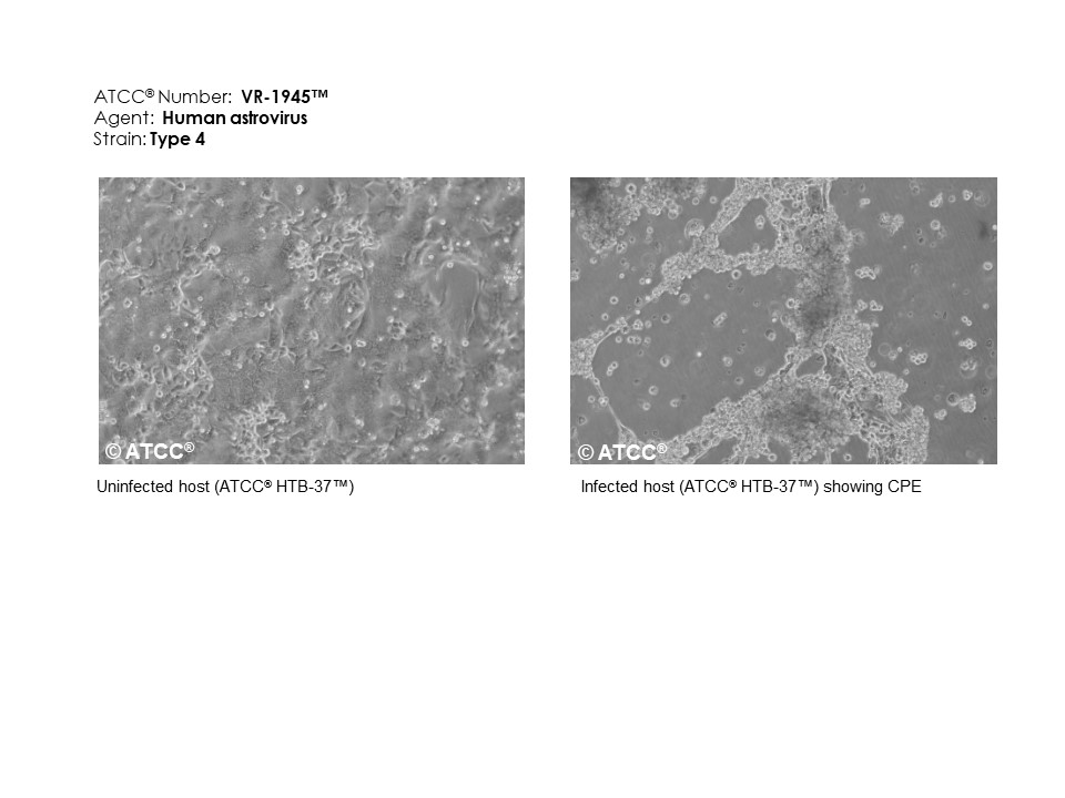 VR-1945 micrograph