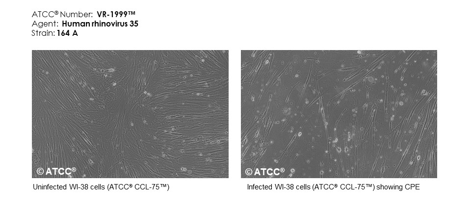 Micrograph of host effects for VR-1999