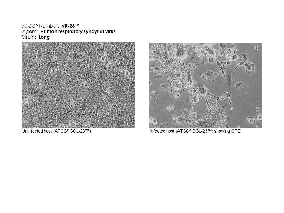 VR-26 Micrograph