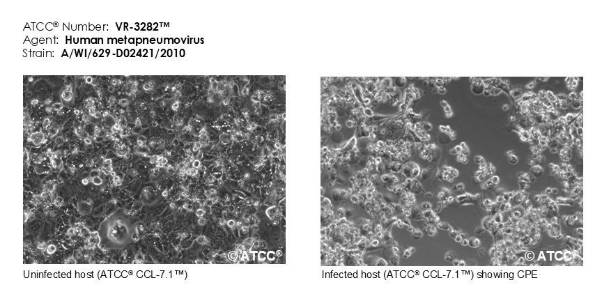 Micrograph of host effects for VR-3282