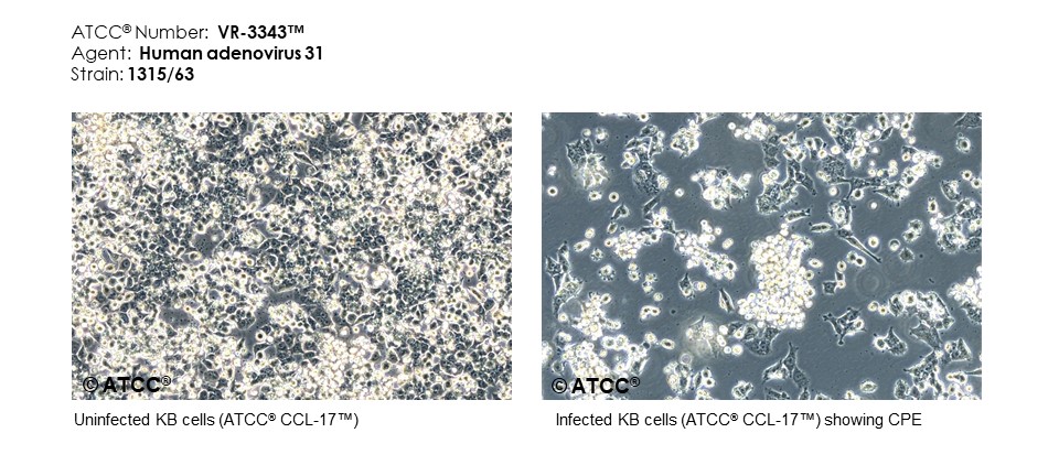 Micrograph of host effects