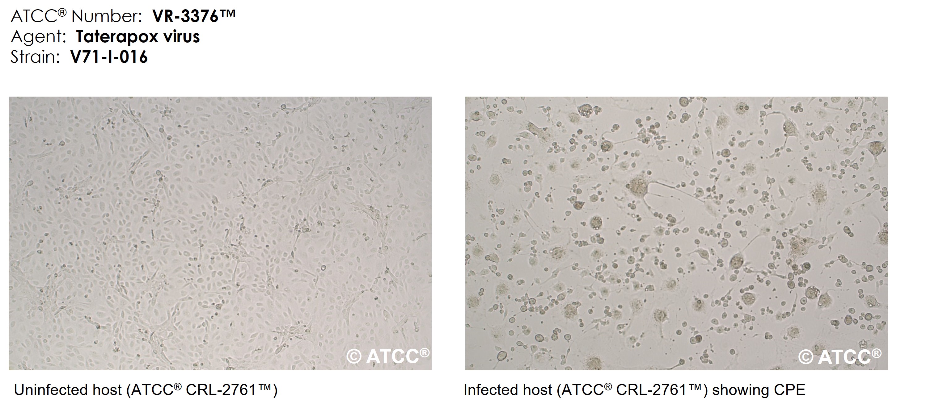 Taterapox virus strain V71-I-016 micrograph