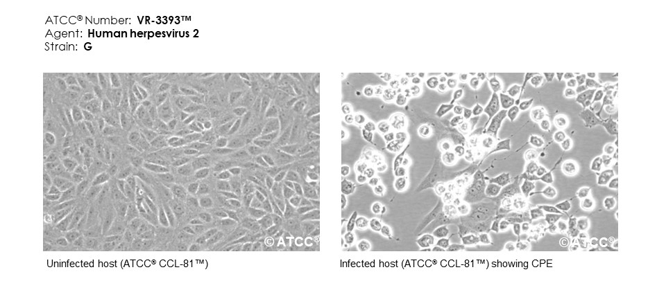 Micrograph of host effects