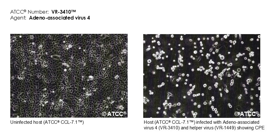 Host cells infected with Adeno-associated virus 4 and helper virus