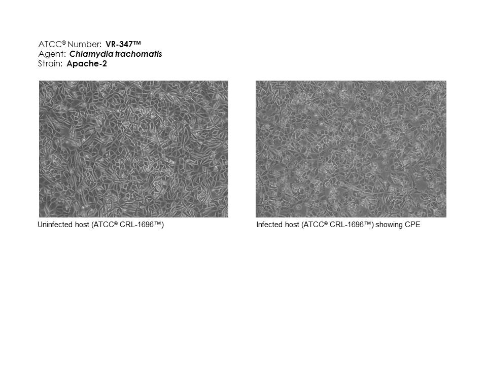 Chlamydia trachomatis ATCC VR-347 Images