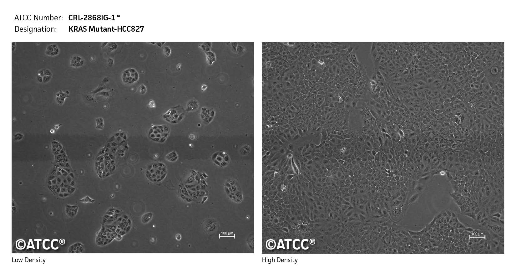 Low density High density Image of CRL-2868IG-1 cells