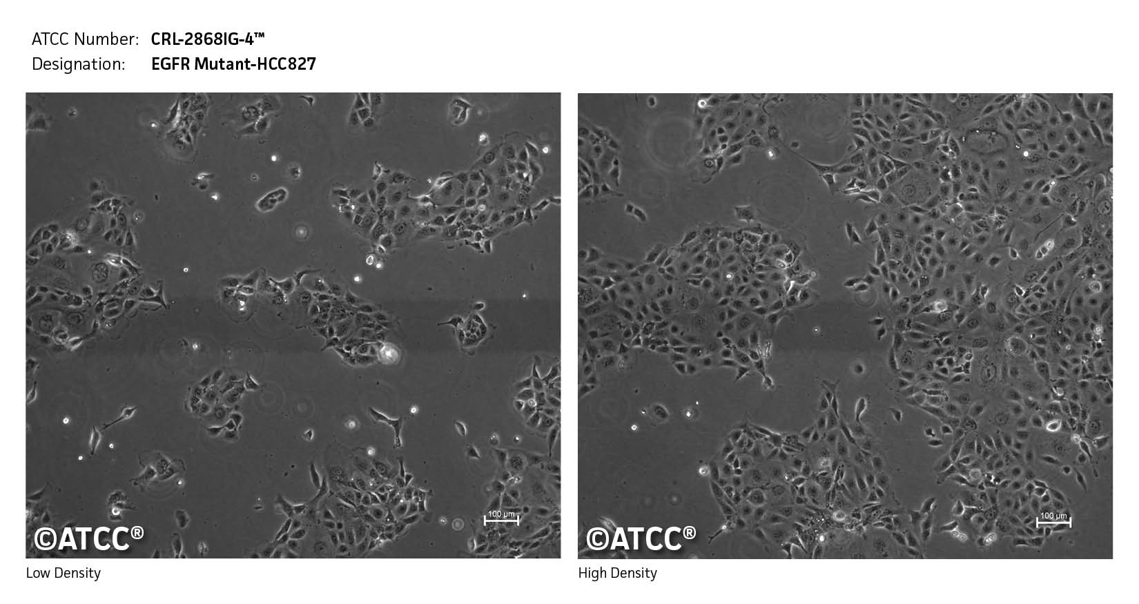 Low density high density image of CRL-2868IG-4 cells 