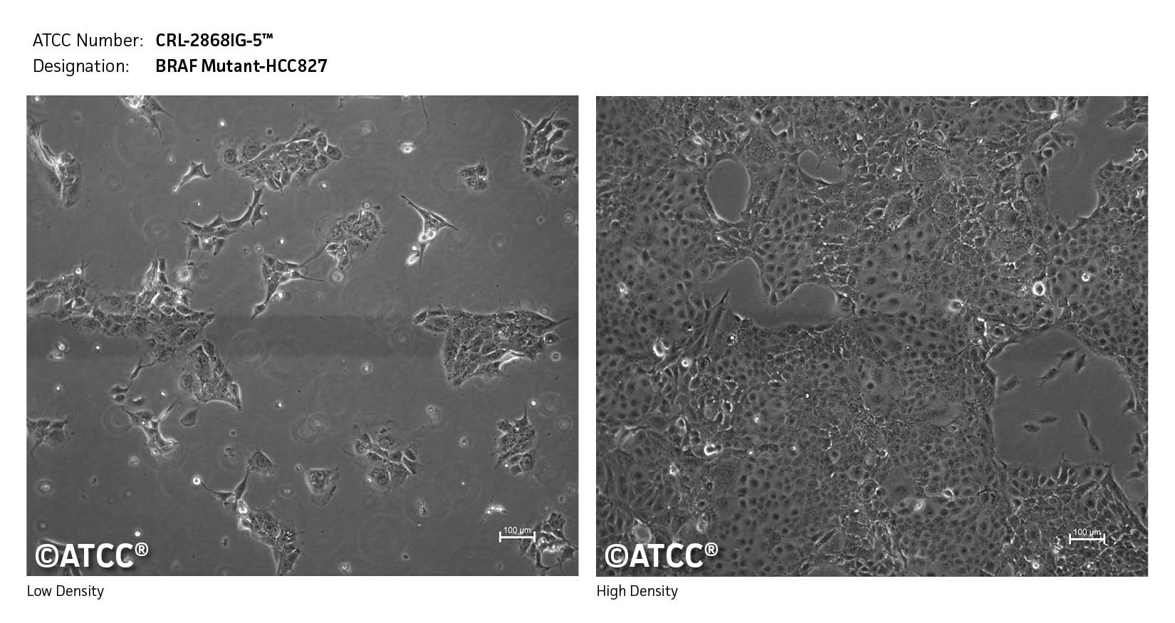 Low density and high density image of CRL-2868IG-5 cells