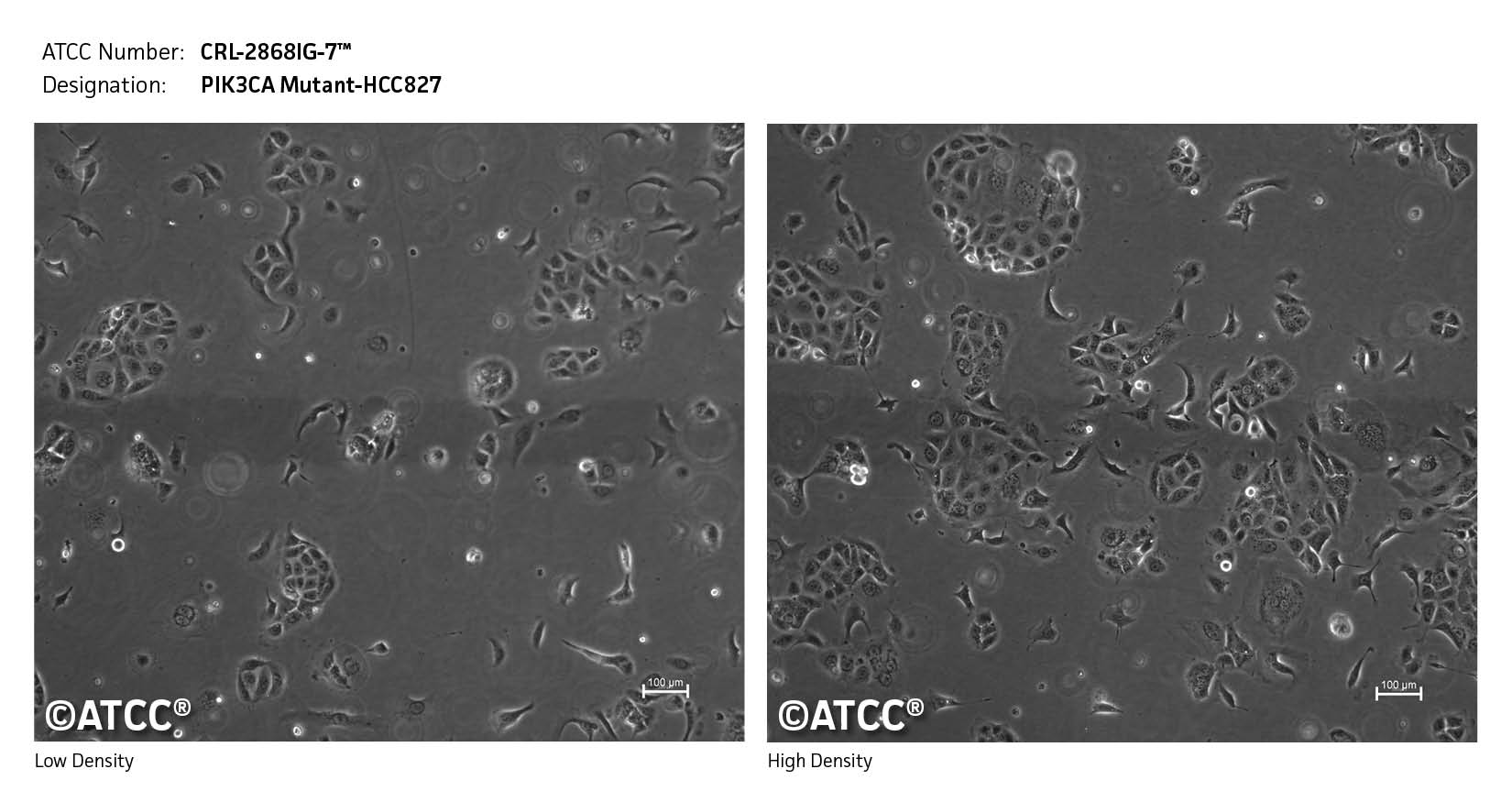Low density high density image of CRL-2868IG-7
