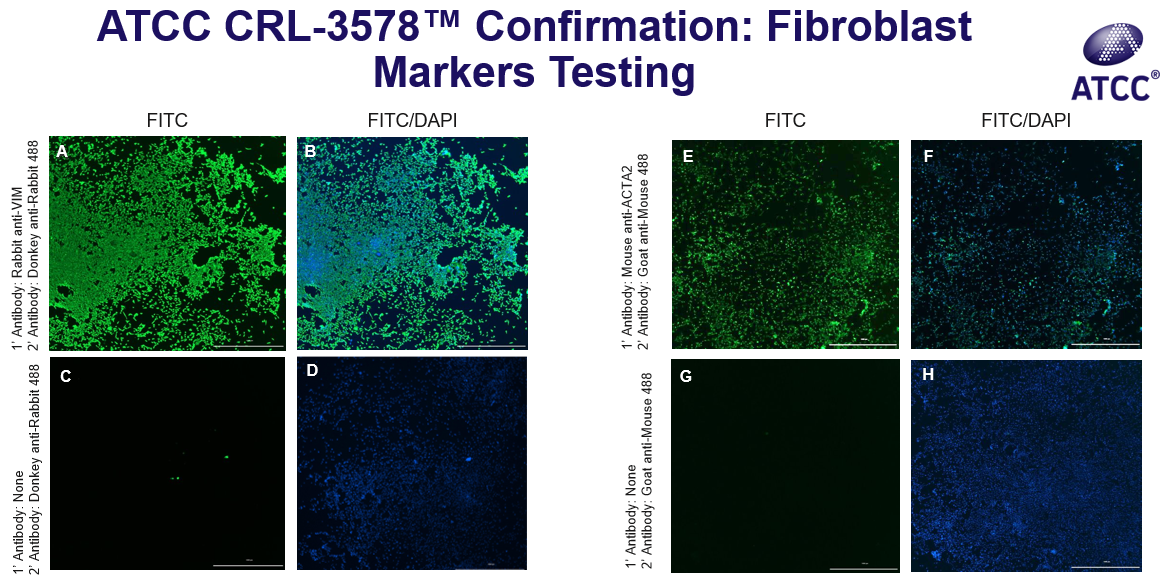 Image of CRL-3578 Confirmation Fibroblast Marker Testing