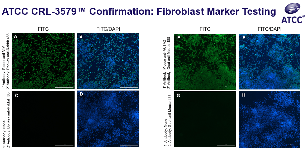 CRL-3579 Confirmation Fibroblast Marker Testing