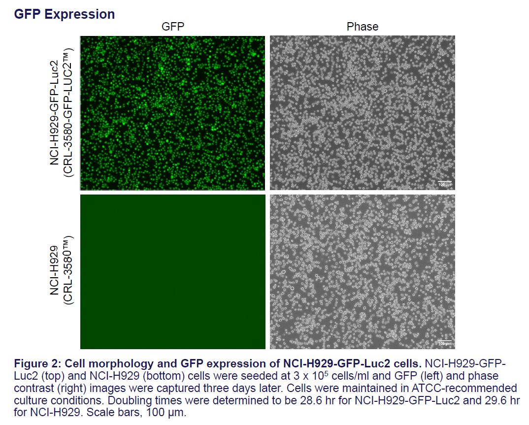 Fig 5 CRL-3580-GFP-LUC2