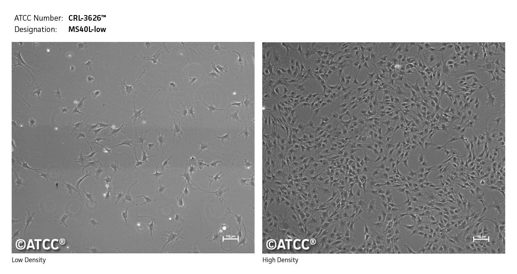 High and low density cell image of CRL-3626