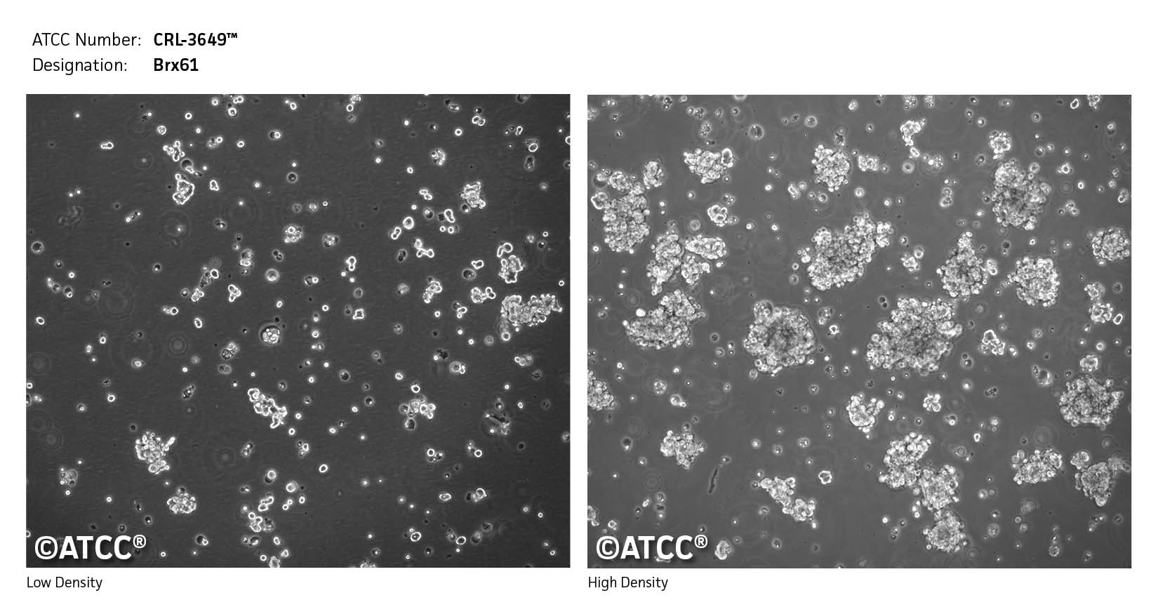 Low density high density image of CRL-3649 cells
