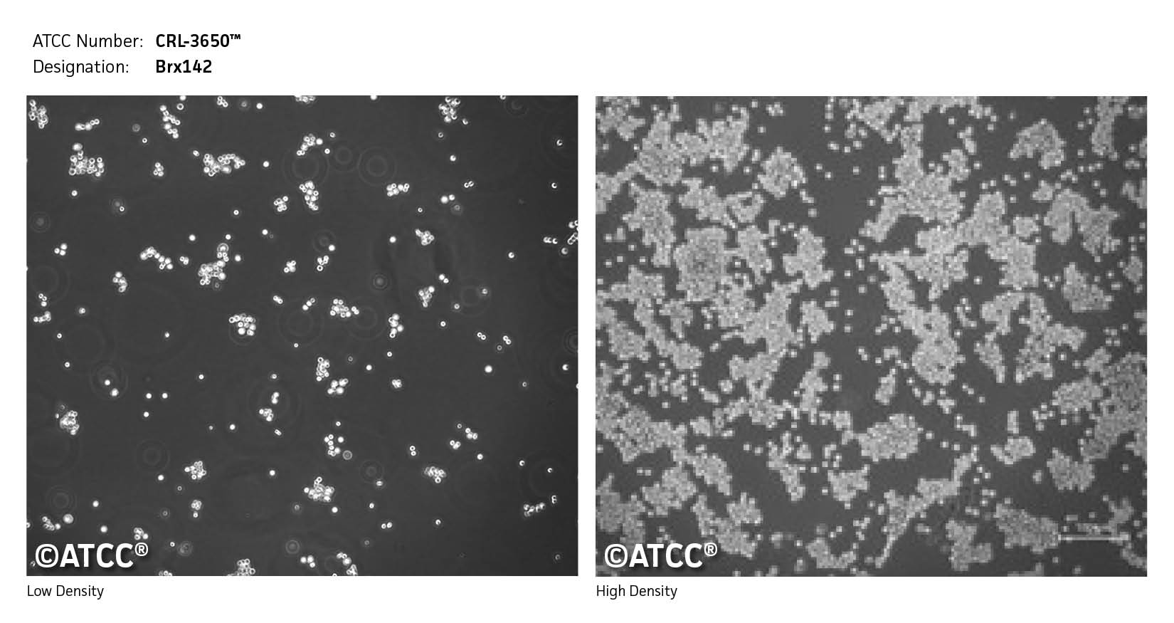 Low and high density image of CRL-3650 Brx142 cells