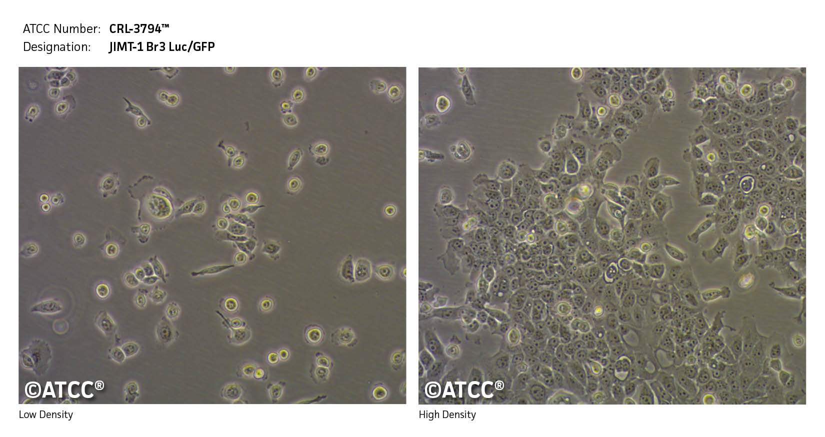 Low and High Density image of CRL-3794 JIMT-1 Br3 Luc/GFP cells