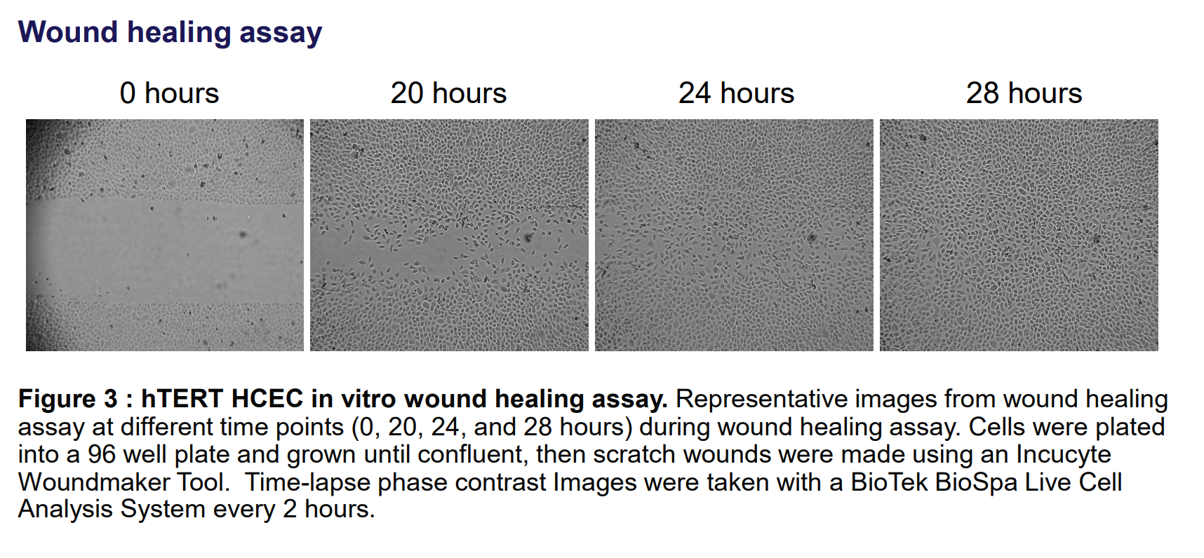 CRL-4067 Wound healing assay