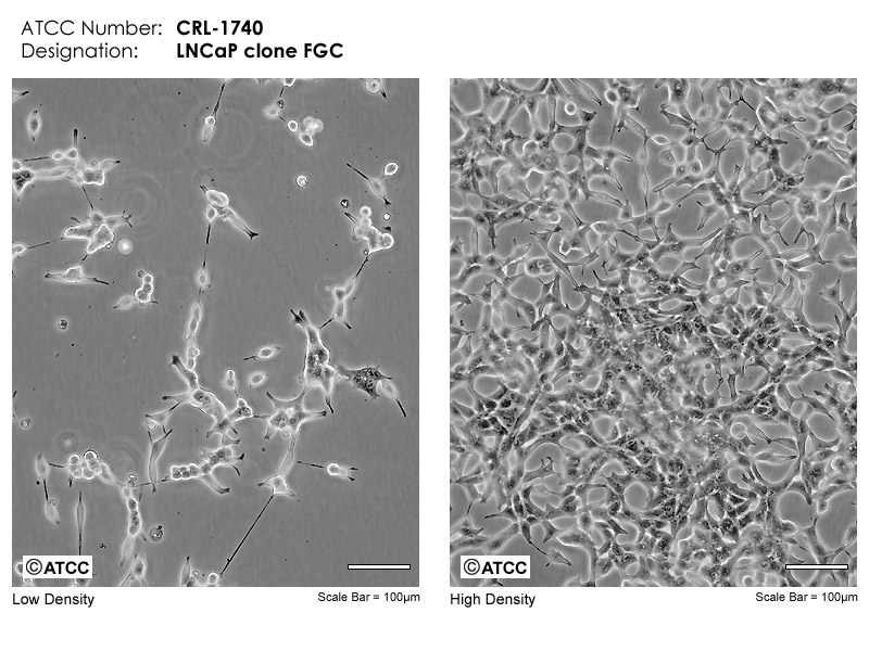 Lncap Clone Fgc Atcc Crl 1740 Homo Sapiens Prostate Deri