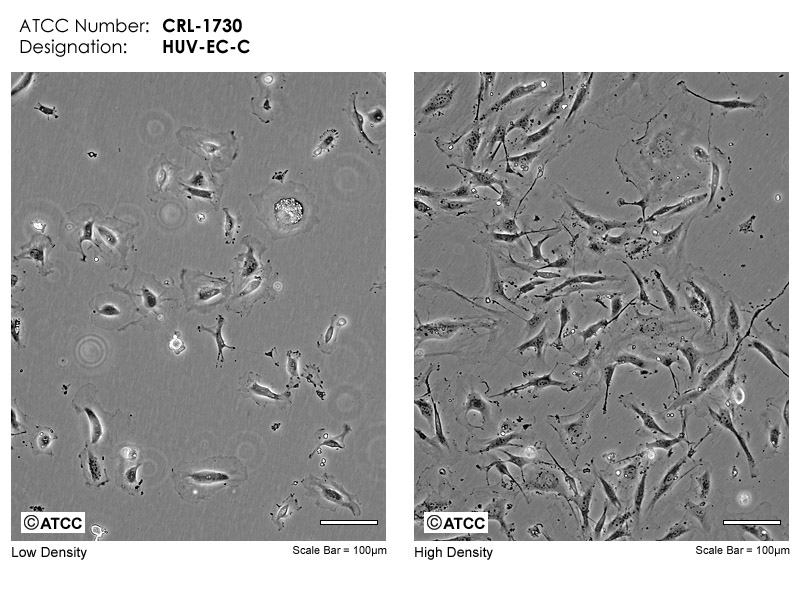 Huv Ec C Huvec Atcc Crl 1730 Homo Sapiens Umbilical Vei