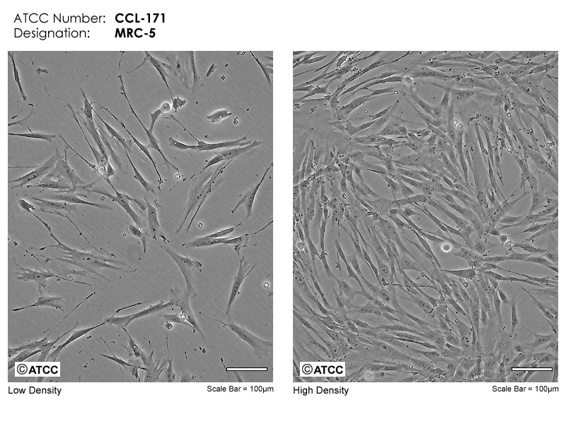 Image result for mrc5 cell culture fibroblast