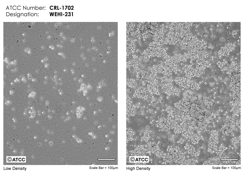 Wehi 231 Atcc Crl 1702 Mus Musculus B Cell Lymphoma